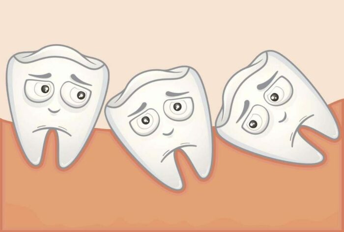dents